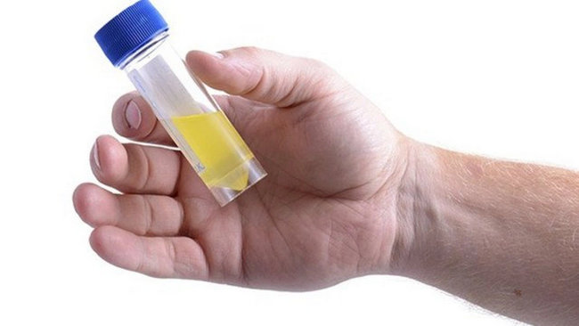 Nguyên nhân nước tiểu duc