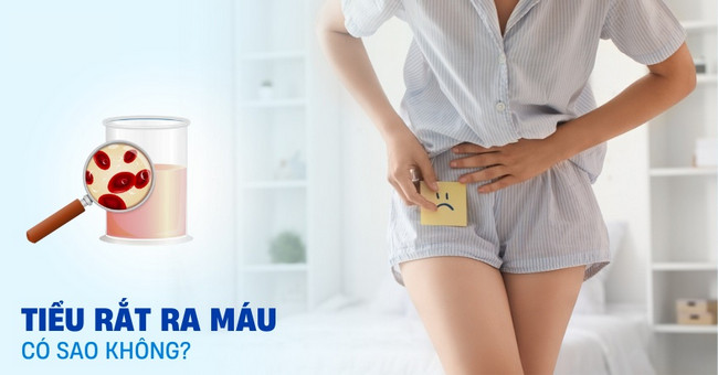 tieu rat ra mau co sao khong