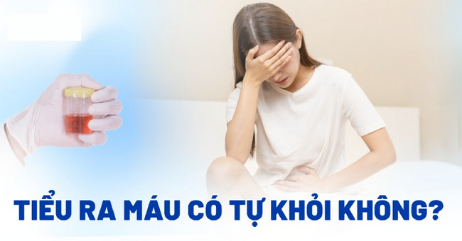 tieu ra ra mau co tu khoi khong