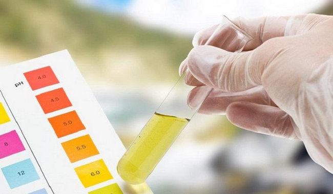 nuoc tieu mau vang khi nao bat thuong