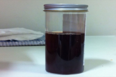 Cách điều trị khi gặp nước tiểu có màu đen bất thường