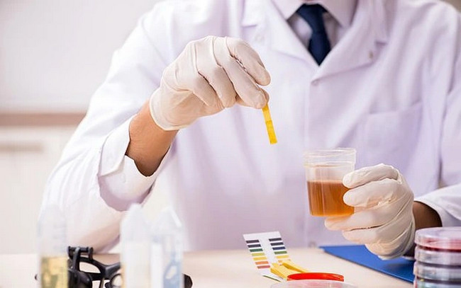 Nguyên nhân khiến nước tiểu ban đêm thường đậm màu