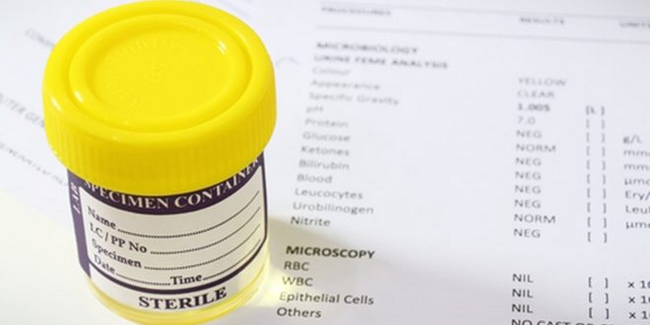 Nước tiểu màu lạ ở trẻ em