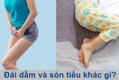 Đái dầm và són tiểu giống và khác nhau ở đâu