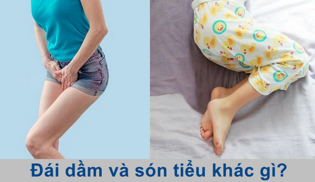 Đái dầm và són tiểu giống và khác nhau ở đâu